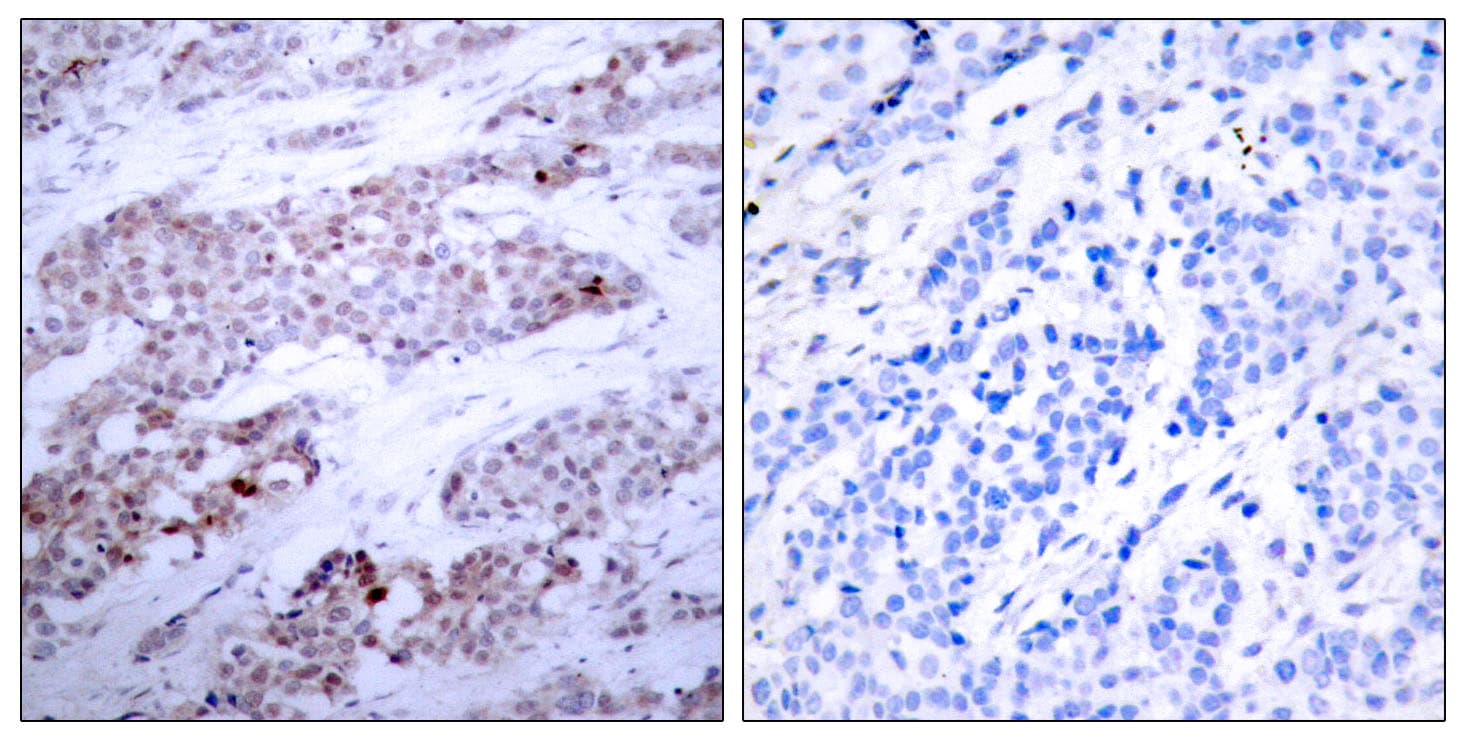Polyclonal Rabbit anti-Human ATF4 Antibody (phospho-Ser245, IHC)
