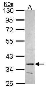 Polyclonal Rabbit anti-Human PRPS2 Antibody (aa1-243, IHC, WB)