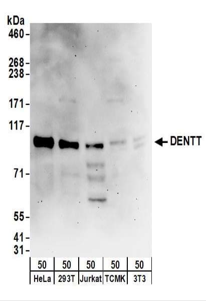 Polyclonal Rabbit anti-Human TSPYL2 / DENTT Antibody (aa1-50, IHC, WB)