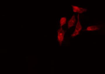 Polyclonal Rabbit anti-Human RPL7L1 Antibody (IF, WB)