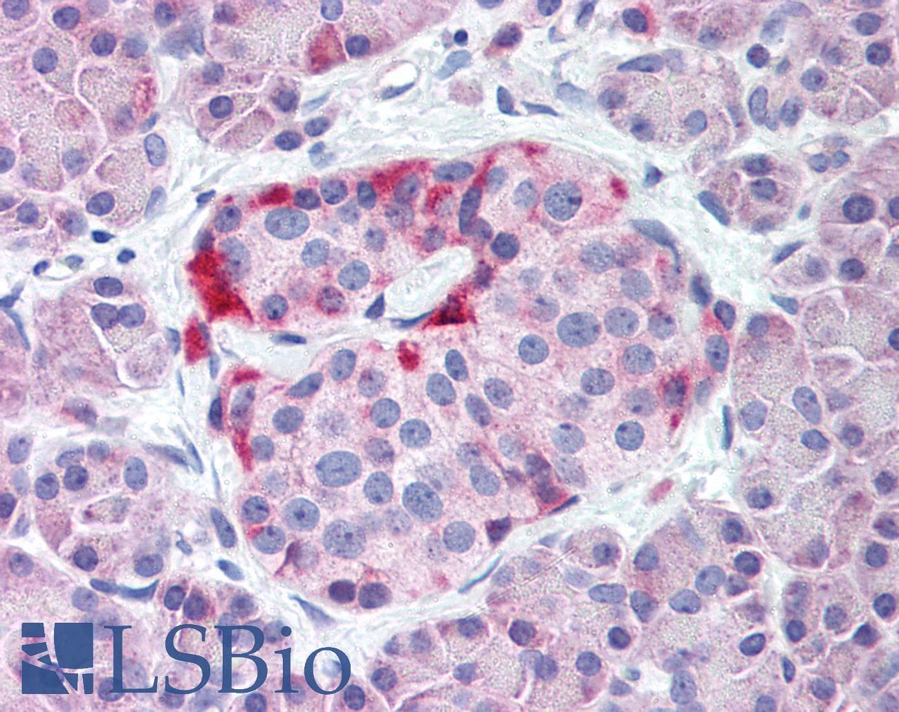 IHC-plus™ KCNJ6 / GIRK2 Antibody (N-Terminus)