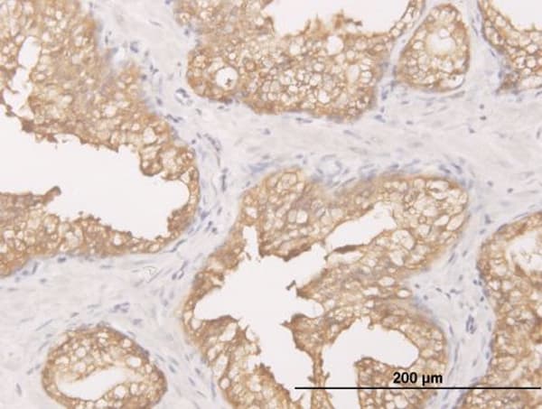 Monoclonal Mouse anti-Human DCXR Antibody (clone 6A6, IHC, WB)