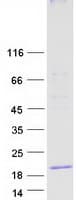 Human MAL Protein (Recombinant Myc-DDK (Flag))