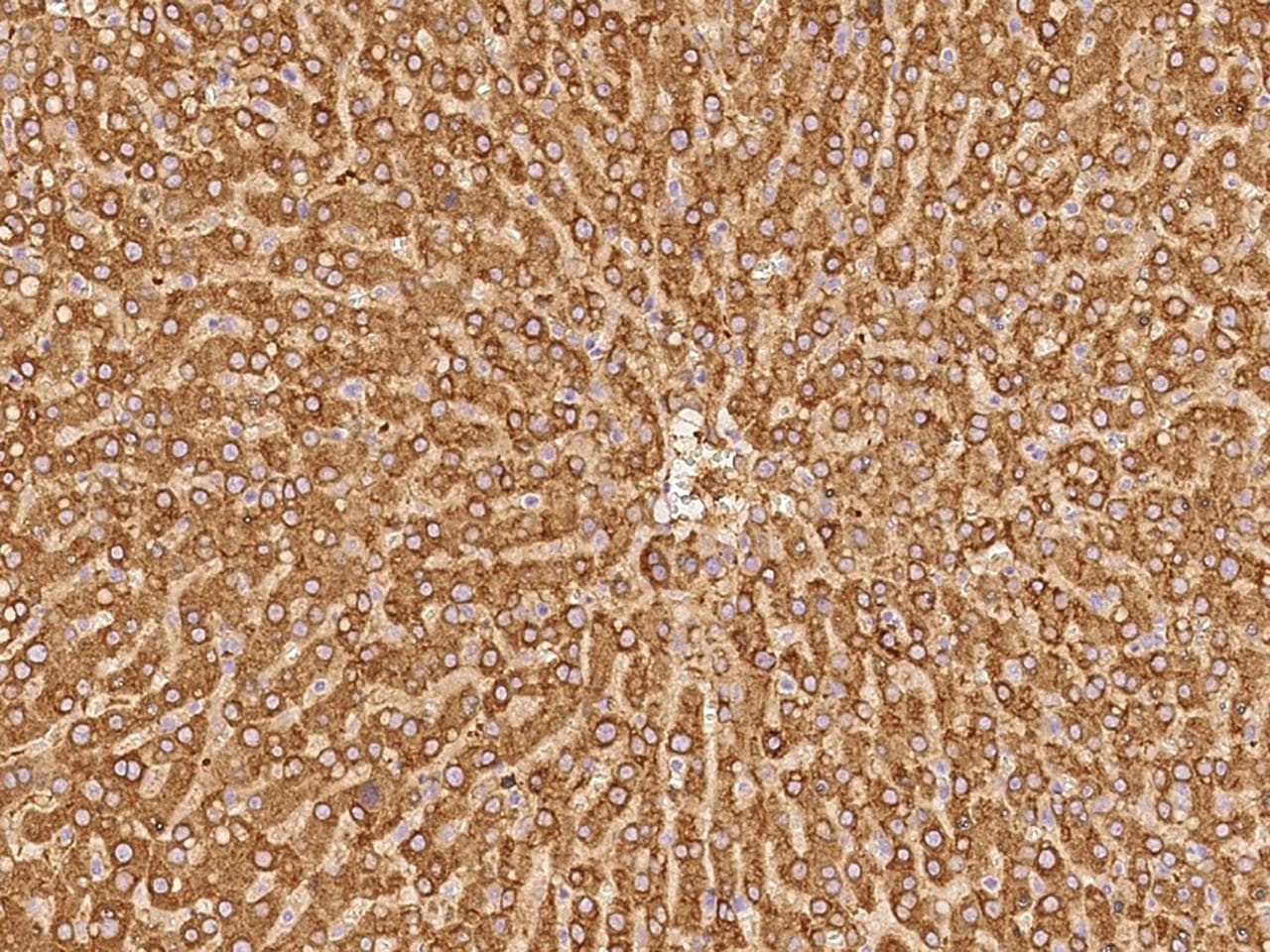 PYGL Antibody
