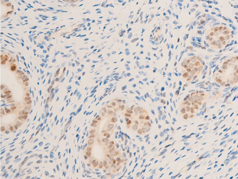 BIRC5 / Survivin Antibody (phospho-Thr117)