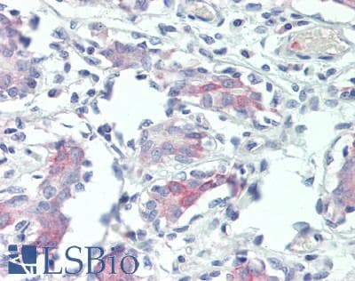 IHC-plus™ MELK Antibody (aa525-575)