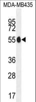 Polyclonal Rabbit anti-Human PAX1 Antibody (aa163-189, WB)