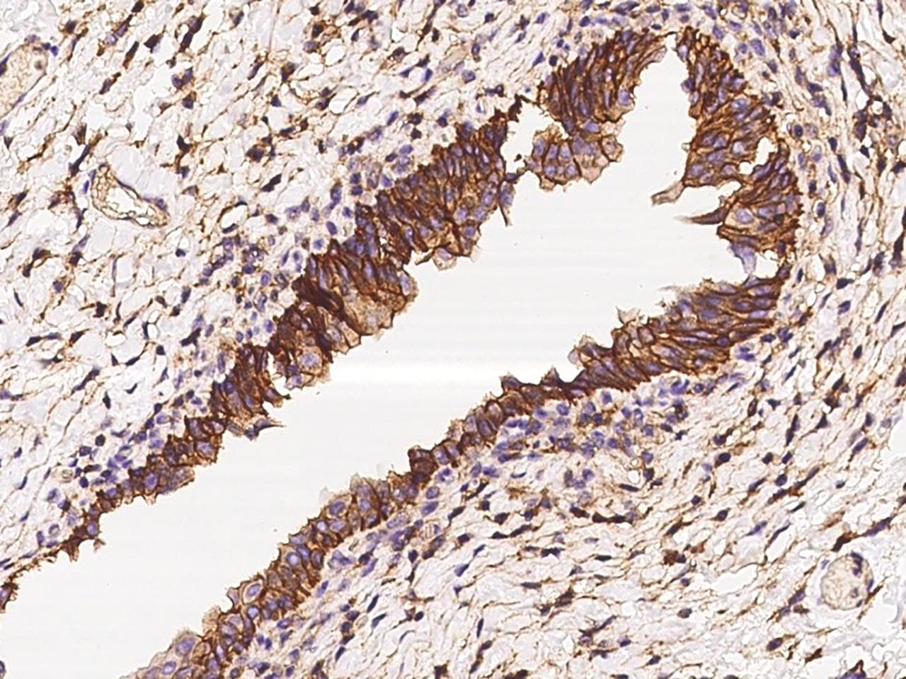 Polyclonal Rabbit anti-Human CD47 Antibody (IHC, IF)