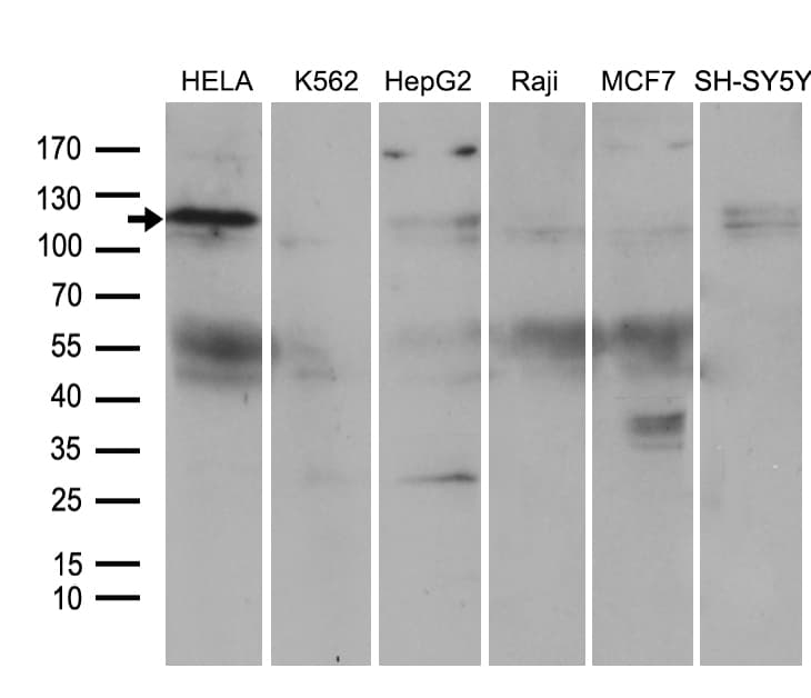 Monoclonal Mouse anti-Human ROR2 Antibody (clone OTI3H3, aa796-927, IHC, WB)