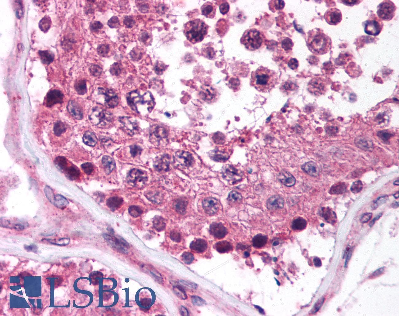 IHC-plus™ MAGEF1 Antibody (aa288-302)