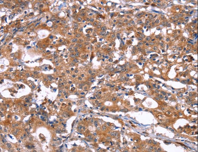 HSD17 / HSD17B1 Antibody