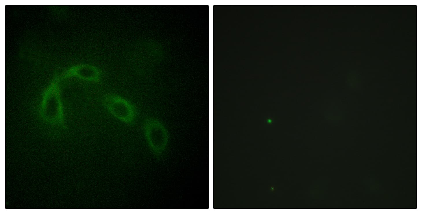 IHC-plus™ PAK1 Antibody (aa165-214)