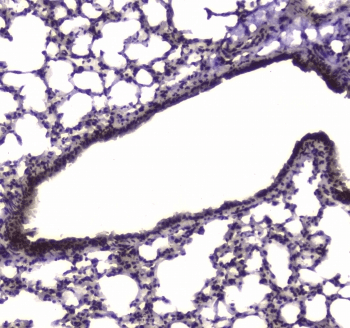 Polyclonal Rabbit anti-Human NFIB Antibody (IHC, WB)
