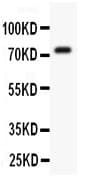 KCND3 / Kv4.3 Antibody (aa1-177)