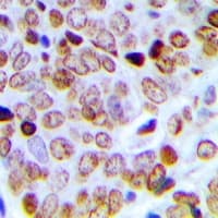 SCAF4 Antibody (Internal)