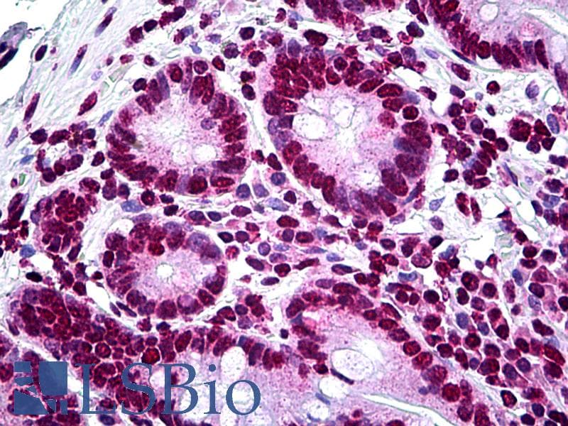 IHC-plus™ LHX1 Antibody (clone 2G10)