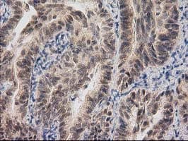 RASSF1 / RASSF1A Antibody (clone OTI2B11)