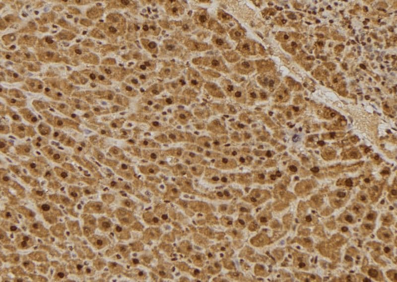 Polyclonal Rabbit anti-Human GC1qR / C1QBP Antibody (IHC, IF, WB)