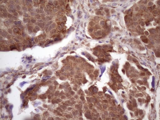 PRPK / TP53RK Antibody (clone OTI4D10, Carrier-free)