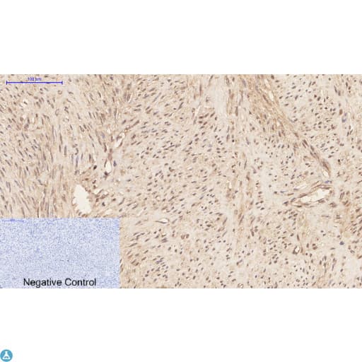 MAPK3 / ERK1 Antibody