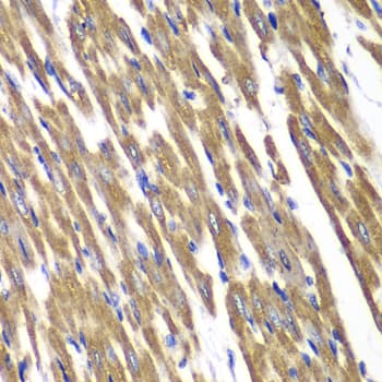 IHC-plus™ SDHA Antibody