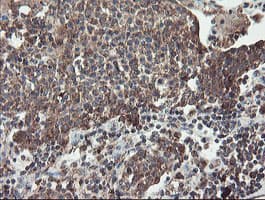 DPH2 Antibody (clone OTI4E7)