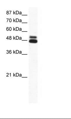 Polyclonal Rabbit anti-Human CHRNB2 Antibody (aa21-70, IHC, WB)