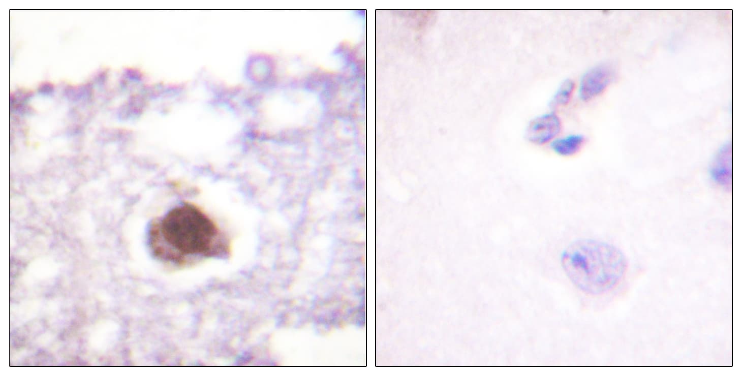 PRKDC / DNA-PKcs Antibody (aa2022-2071)