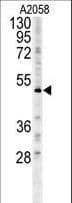 Polyclonal Rabbit anti-Human FOXC2 Antibody (aa159-186, IHC, WB)
