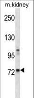 TEC Antibody (aa177-205)