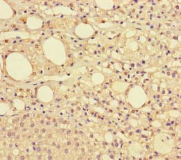 NDUFAF1 / CIA30 Antibody