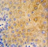 KRT9 / CK9 / Cytokeratin 9 Antibody (aa429-456)