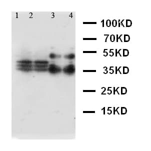 SFTPA1 / Surfactant Protein A Antibody (aa233-248)