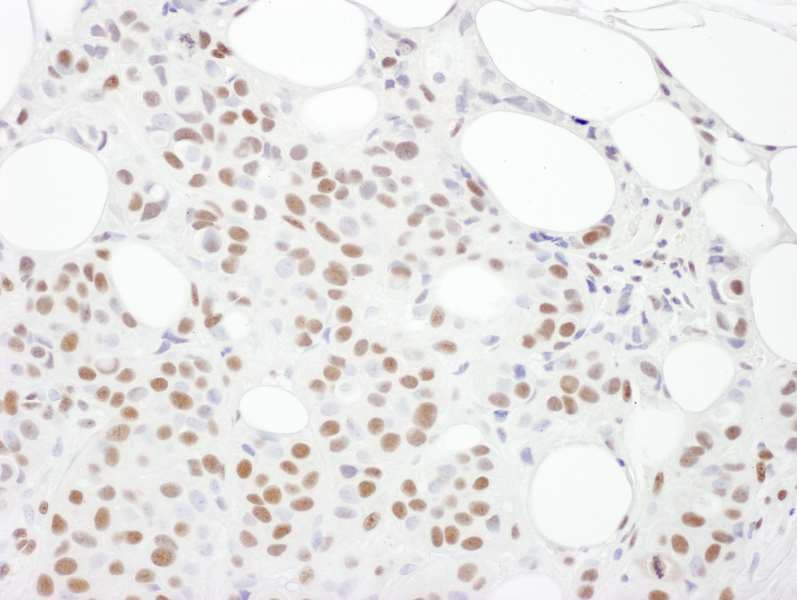 PRKDC / DNA-PKcs Antibody (aa4078-4128)