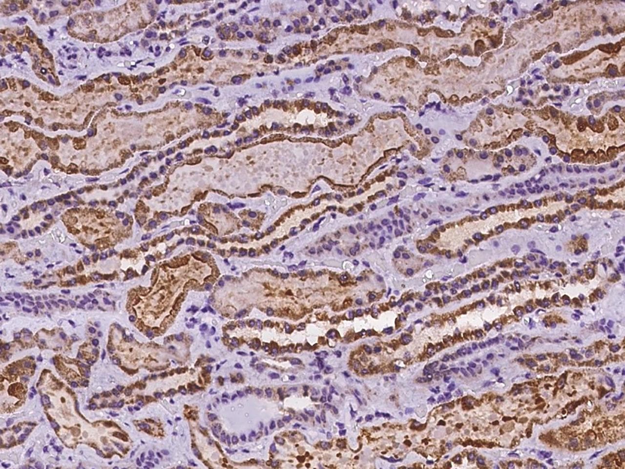Polyclonal Rabbit anti-Human CLDN10 / Claudin 10 Antibody (IHC)