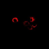 SORD / Sorbitol Dehydrogenase Antibody