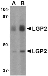 IHC-plus™ DHX58 / LGP2 Antibody