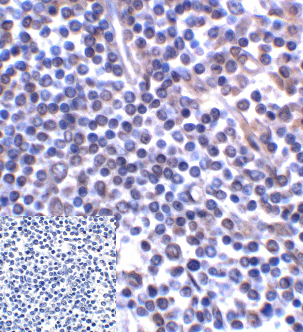 CD276 / B7-H3 Antibody (clone 10G6)