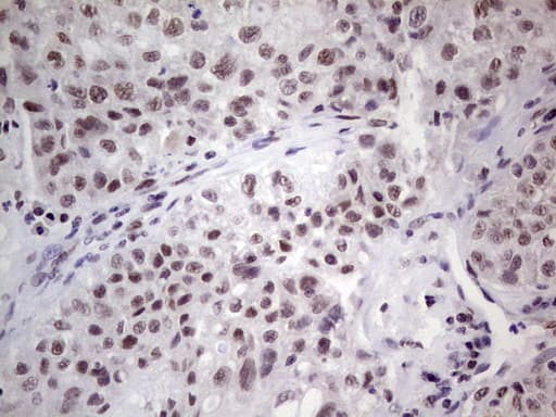 Monoclonal Mouse anti-Human ERCC1 Antibody (clone OTI2H1, IHC, WB)