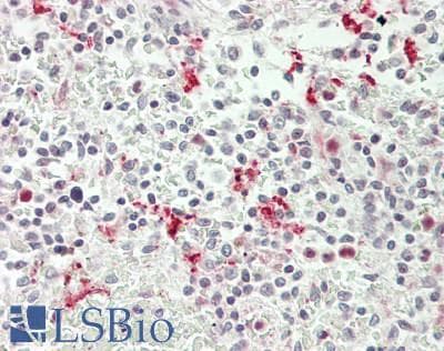 IHC-plus™ ULK2 Antibody (C-Terminus)