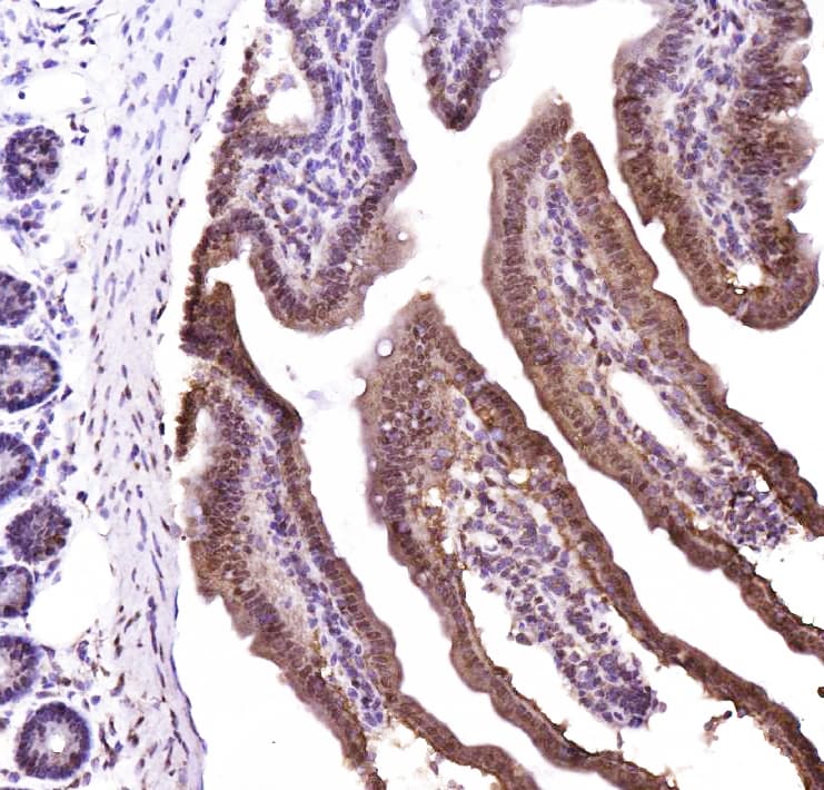 Polyclonal Rabbit anti-Human CTBP2 Antibody (aa429-445, IHC, WB)