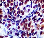 SMARCB1 / INI1 Antibody (clone 25, Ready-to-Use)