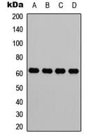 HNRNPK / hnRNP K Antibody (Internal)