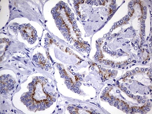 AMACR / P504S Antibody (clone OTI5G8)