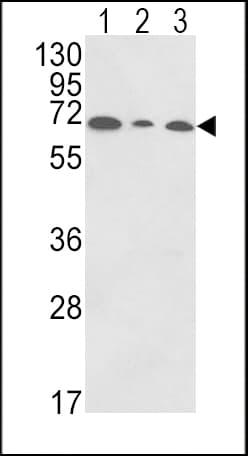 PIGR Antibody (aa646-672)