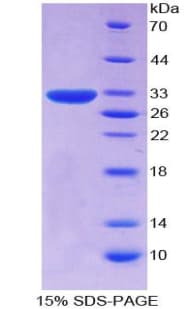 Human CD109 Protein (Recombinant His-T7)