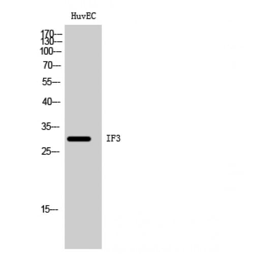 Polyclonal Rabbit anti-Human IF3mt / MTIF3 Antibody (40-120 aa, Internal, IHC, WB)