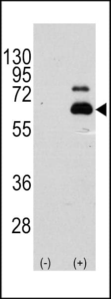 RPS6KB1 / P70S6K / S6K Antibody (Ser404)
