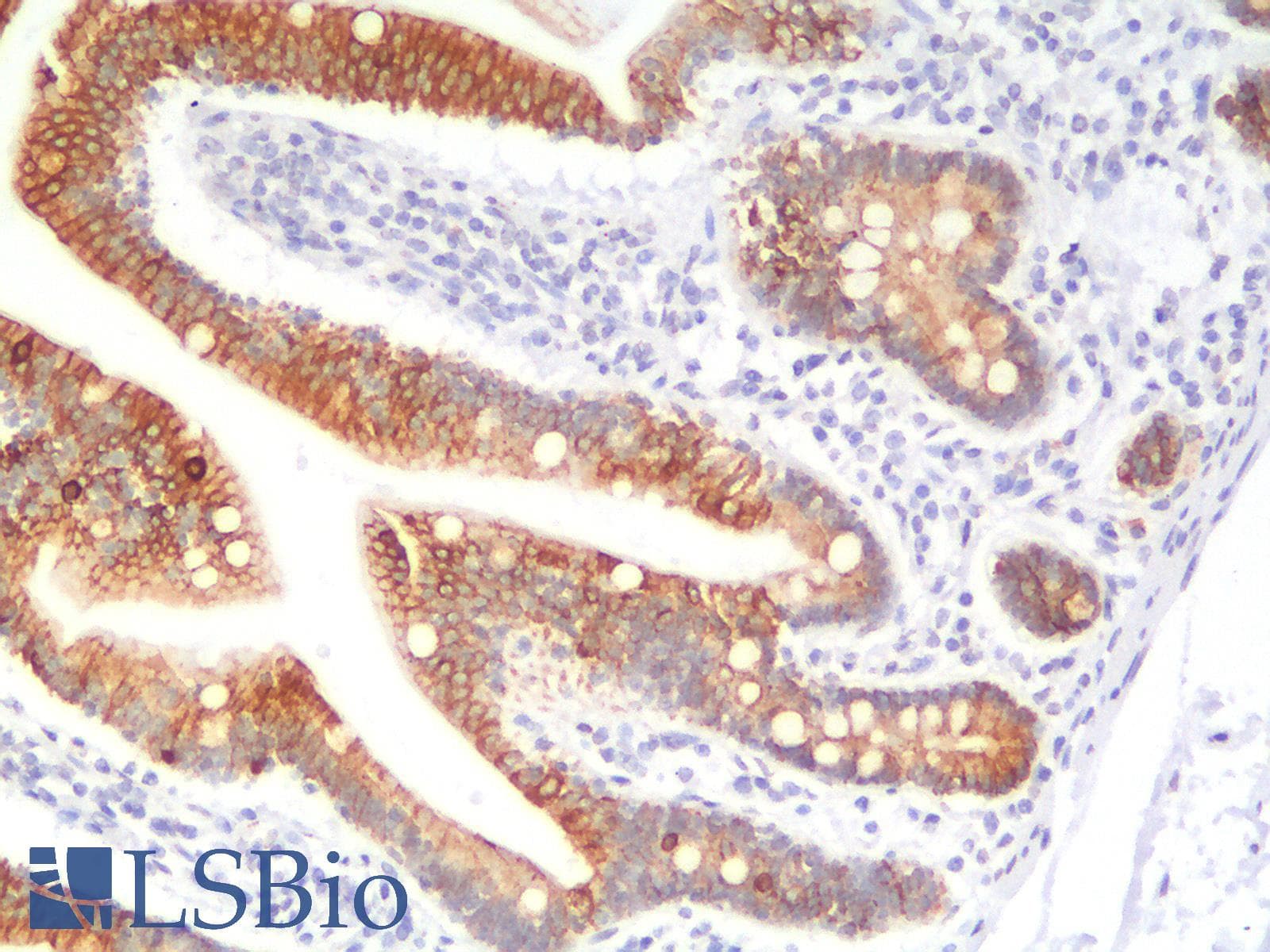 IHC-plus™ KRT18 / CK18 / Cytokeratin 18 Antibody (clone KRT18/2819R)