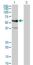 Monoclonal Mouse anti-Human MYC / c-Myc Antibody (clone 1G7, IHC, WB)